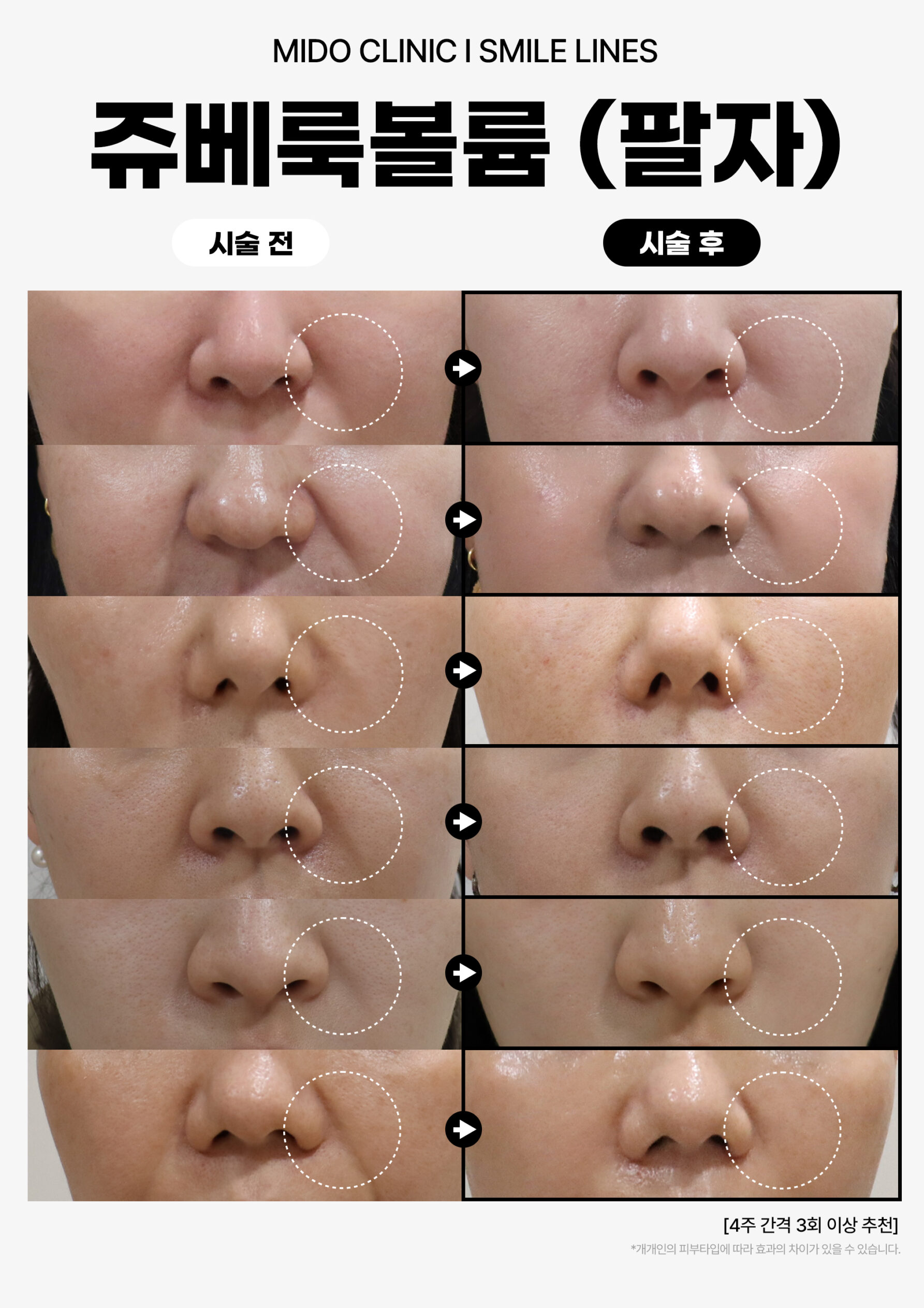 쥬베룩볼륨_팔자001