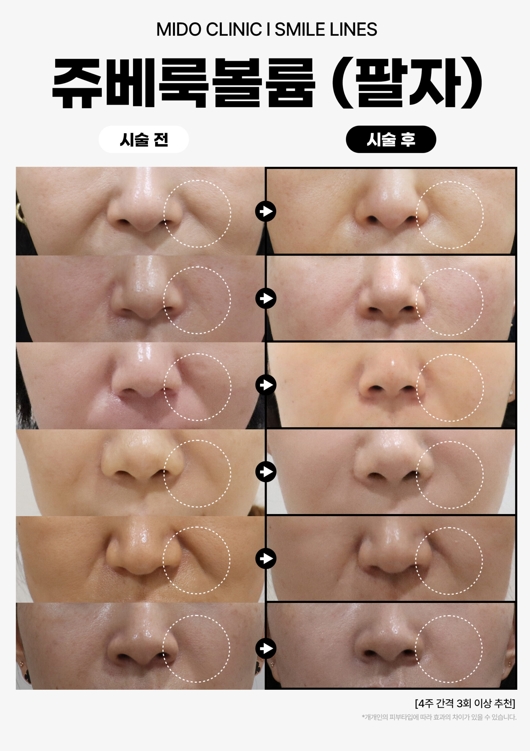 쥬베룩볼륨_팔자003